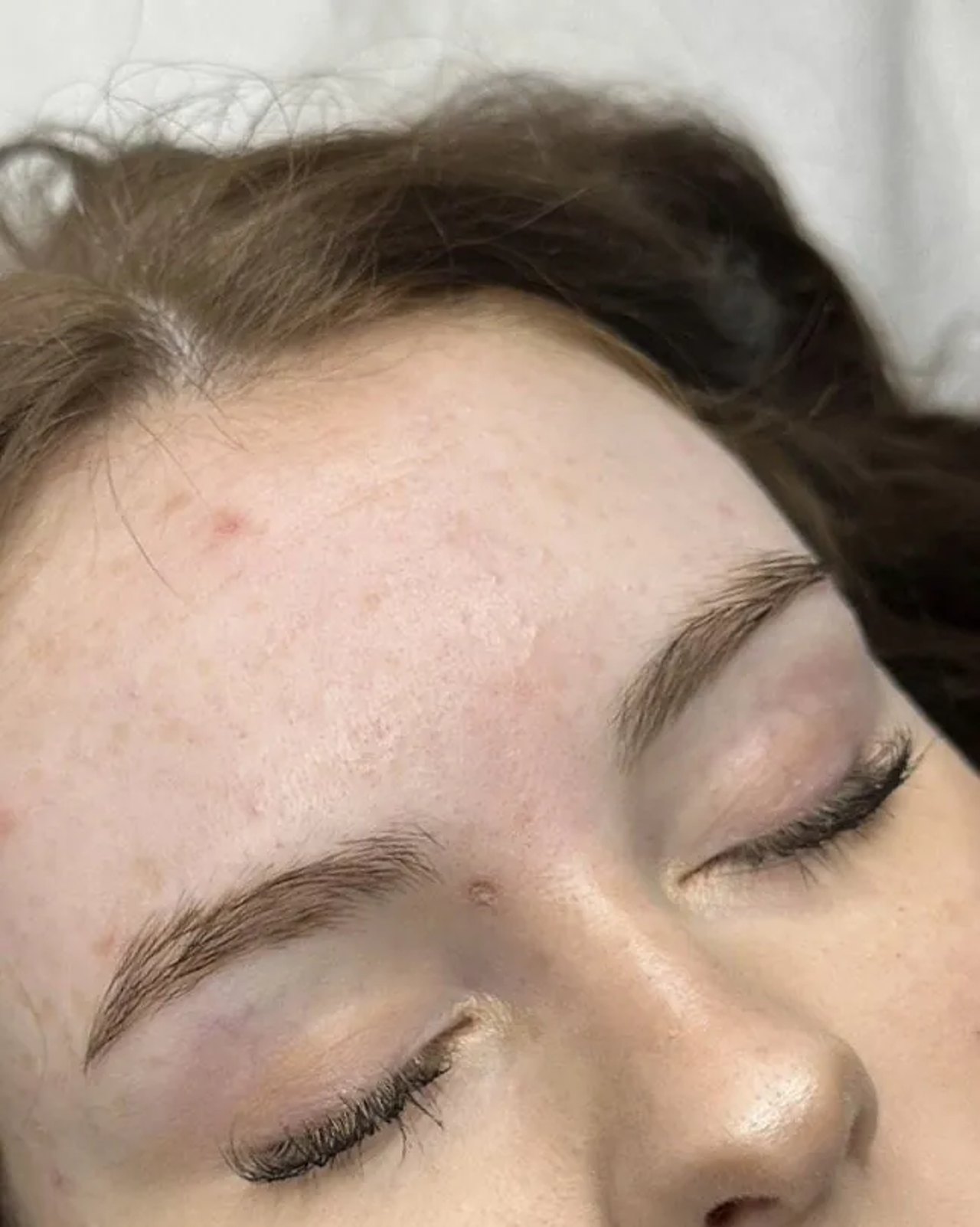 Augenbrauen vor der Behandlung