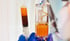 Adipose-Derived stem cells therapy training Clearwater FL