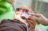 Füllungen für Kinderzähne
