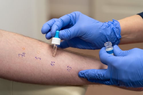 Allergietest in Dresden