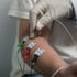 A person undergoes electrodiagnostic testing on their arm.
