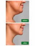 Endolaser Visualisierung