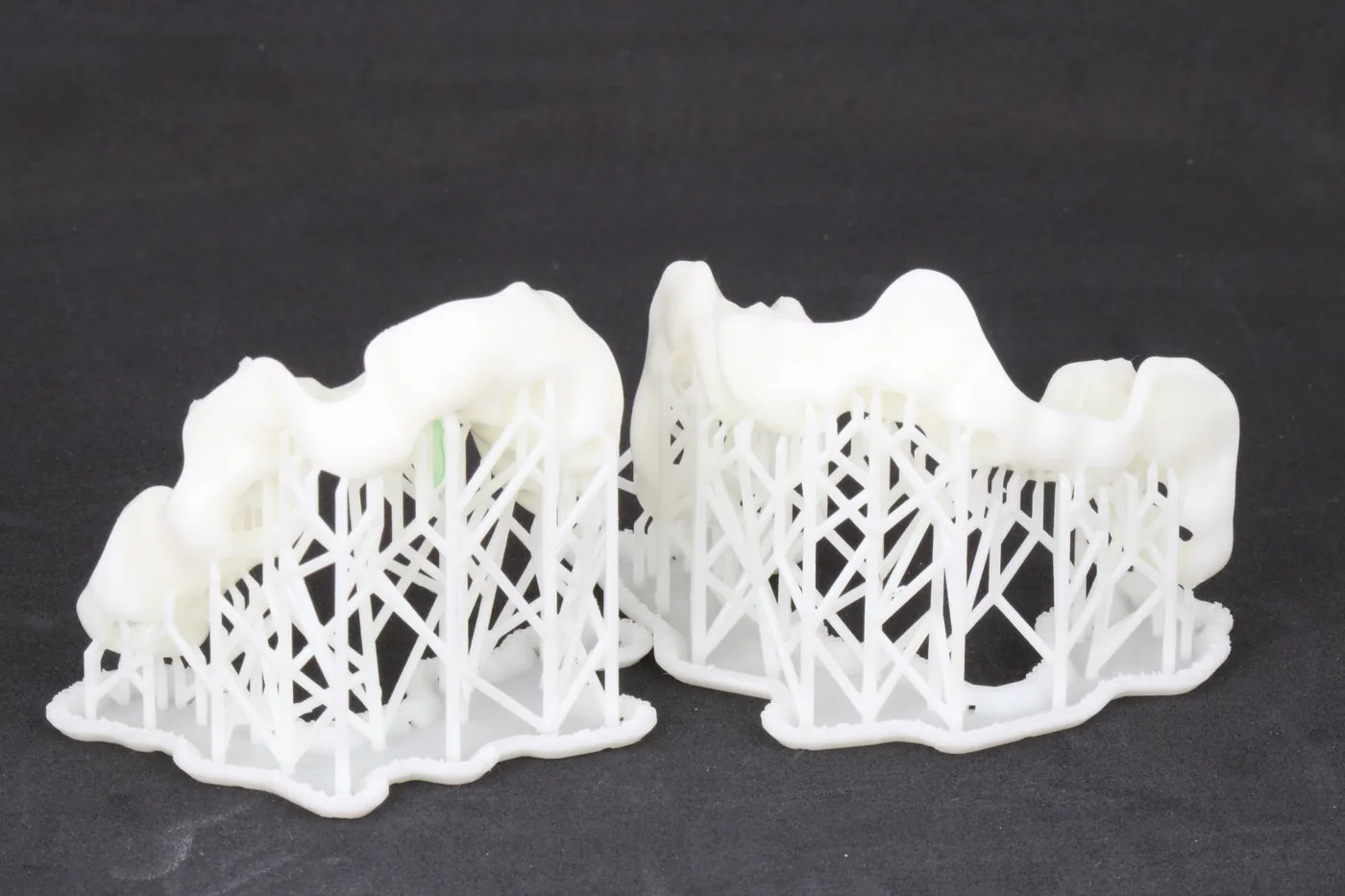 3D-gedruckte Bohrschablonen von ADU-Dental