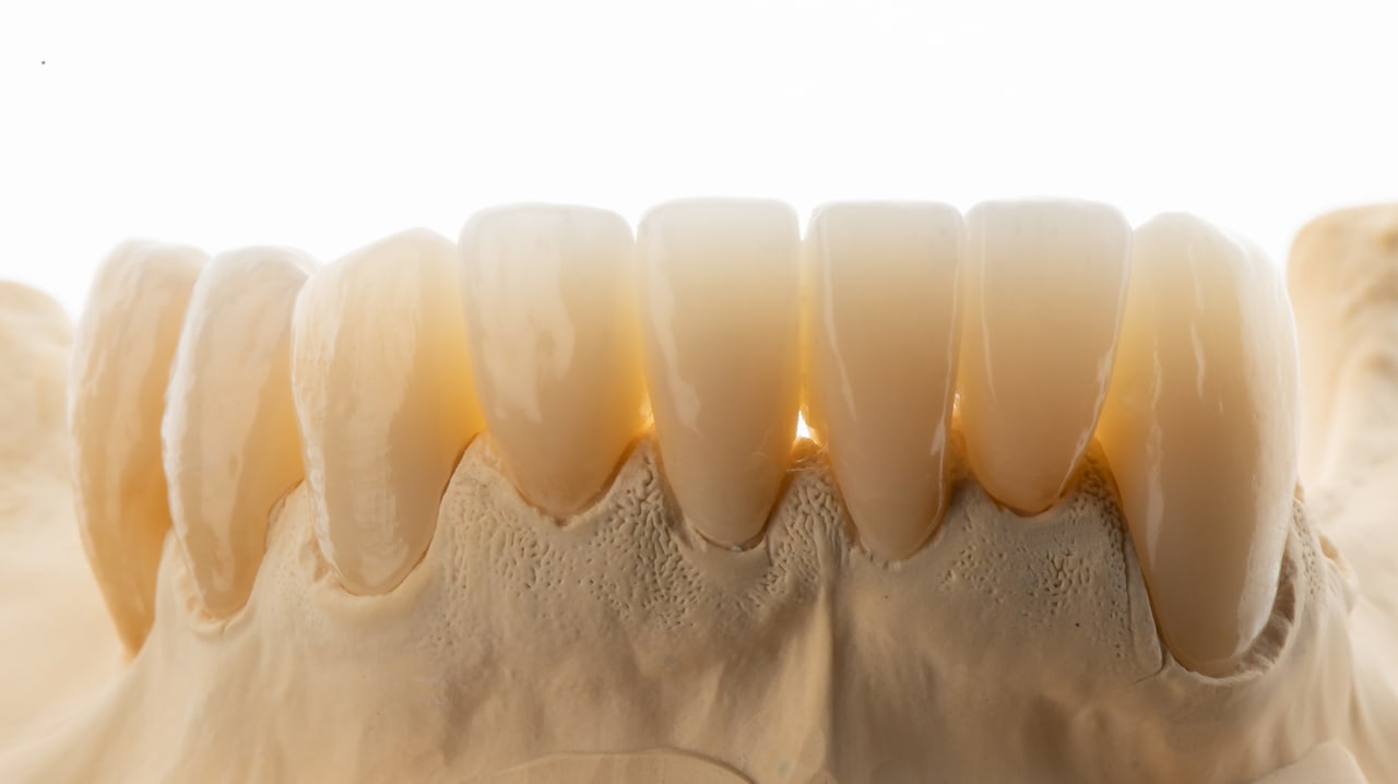 Dentalfoto: Nahaufnahme