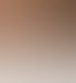 Vorher-Nachher-Vergleich von Akne-Narben im Gesicht nach sechs Behandlungen mit dem SkinPen Microneedling-System.