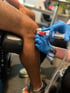 A doctor injects a PRP shot into a patient's knee.