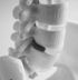 Muscle weakness from sciatica care Baltimore