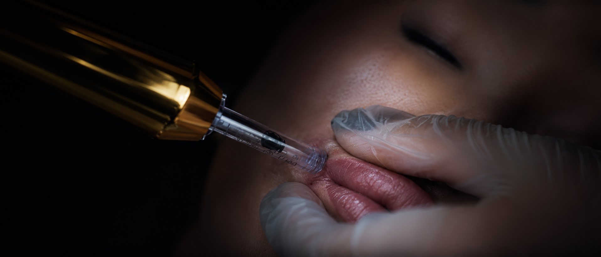 BLACK SWON · Lippenvolumen