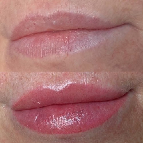 Vergleich einer Lippenpigmentierung aus der Praxis von Sara Pavo