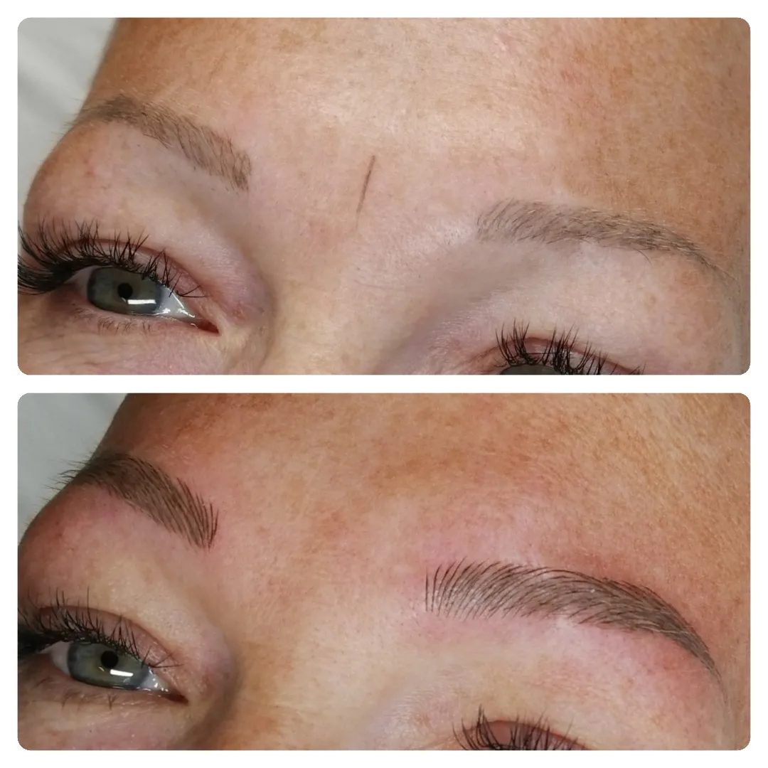 Cover-up einer alten Pigmentierung