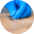 Dry needling physical therapy for pain relief 