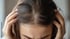 ThinningHair