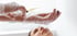 Gloved hands preparing stem cell injection for joint and tissue pain