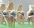 Knee pain treatment in Baltimore MD