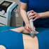 Snowflake Arizona shockwave treatment

