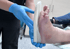 Eine Person in blauen Handschuhen passt eine weiße orthopädische Einlegesohle an die Fußsohle eines Patienten an.