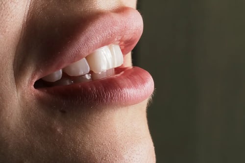 dental-photo-systeme_PIC_73