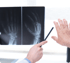 Doctor explaining knee anatomy using a model during consultation
