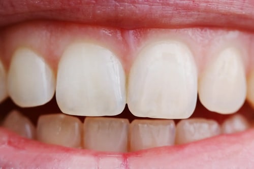 dental-photo-systeme_LateralKit