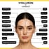 Botox und Hyaluron Behandlungszonen im Gesicht – Übersicht mit Preisen bei noblessO Herford