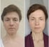 Der Effekt von Facefitness: eine Kundin von Facefitness by Anna Bernwald