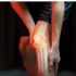 Person holding knee with glowing joint, illustrating orthopedic therapy