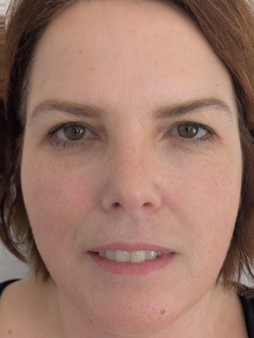 Marion nachher