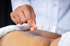 Laguna Beach CA Traditional Acupuncture