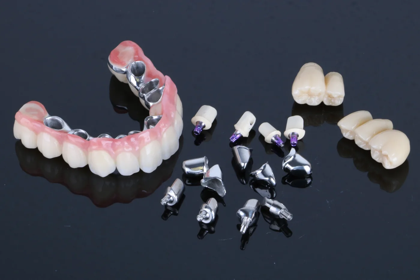 Titan-Teleskopversorgung mit Primärteleskopen auf individuellen Titan-Abutments von ADU-Dental