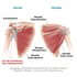 Schulteransicht vorne und hinten, mit Beschriftungen: Supraspinatus, Infraspinatus, Subscapularis, Teres minor.