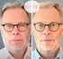 Ein Mann mit Brille, Vorher-Nachher-Vergleich, mit "Mimi Ruth" Logo.