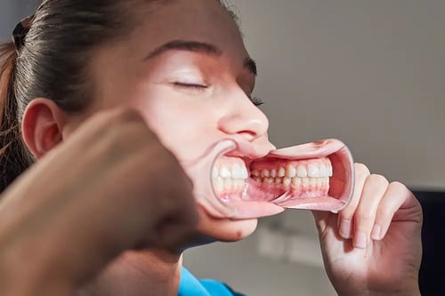 dental-photo-systeme-02