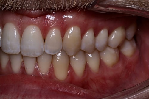 Dentalfoto: Fotostatus seitlich