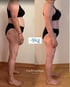 Vorher-Nachher-Vergleich einer Frau in Unterwäsche mit dem Text -9kg und FeelYourBest Logo.