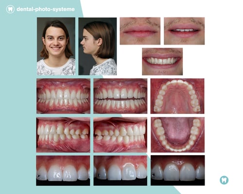 Kompletter Fotostatus, fotografiert mit dem Dental-Kit