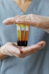 A medical professional holding a rack of test tubes with blood.
