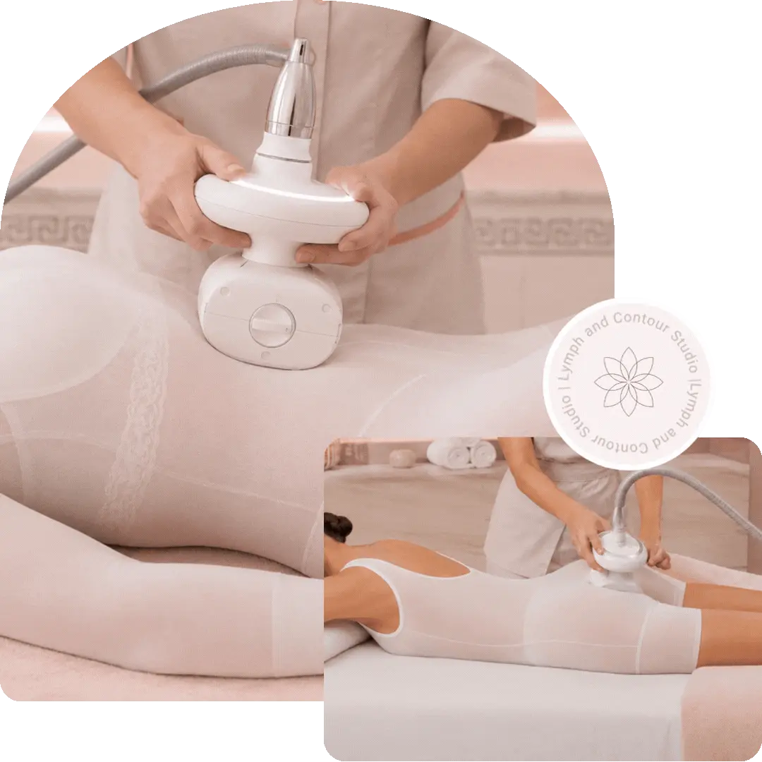 A woman receiving a body contouring treatment on her glutes and abdomen