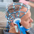 A patient undergoes a qEEG brain mapping test.
