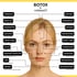 Botox und Hyaluron Behandlungszonen im Gesicht – Übersicht mit Preisen bei noblessO Herford