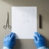 Pre-operative markings are agreed with you before anaesthesia.