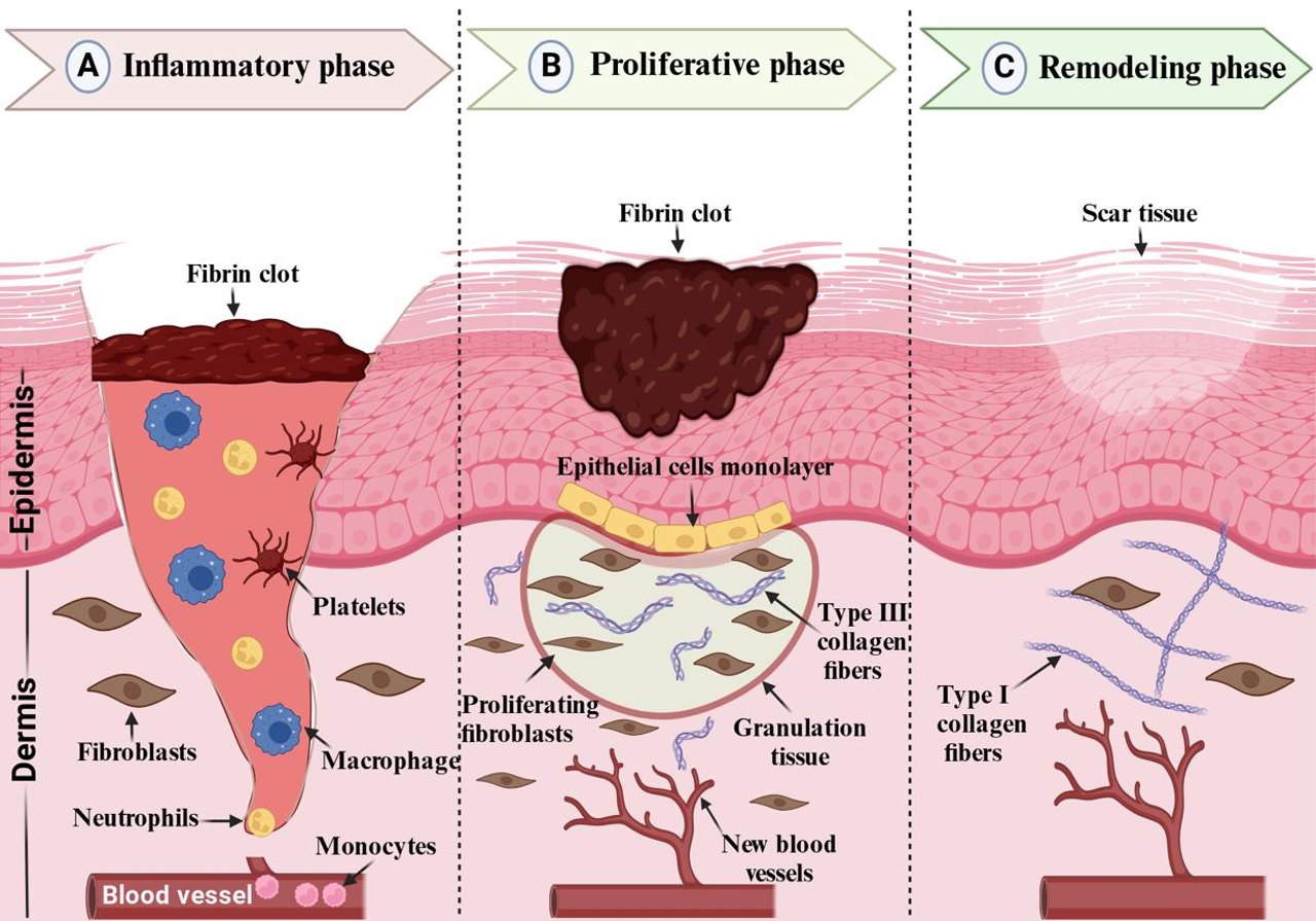 Schematische Illustration der Epithelisierung einer Wunde
