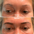 Augenbrauen einer Frau vor und nach dem Microblading, mit den Überschriften "Vorher" und "Nachher".