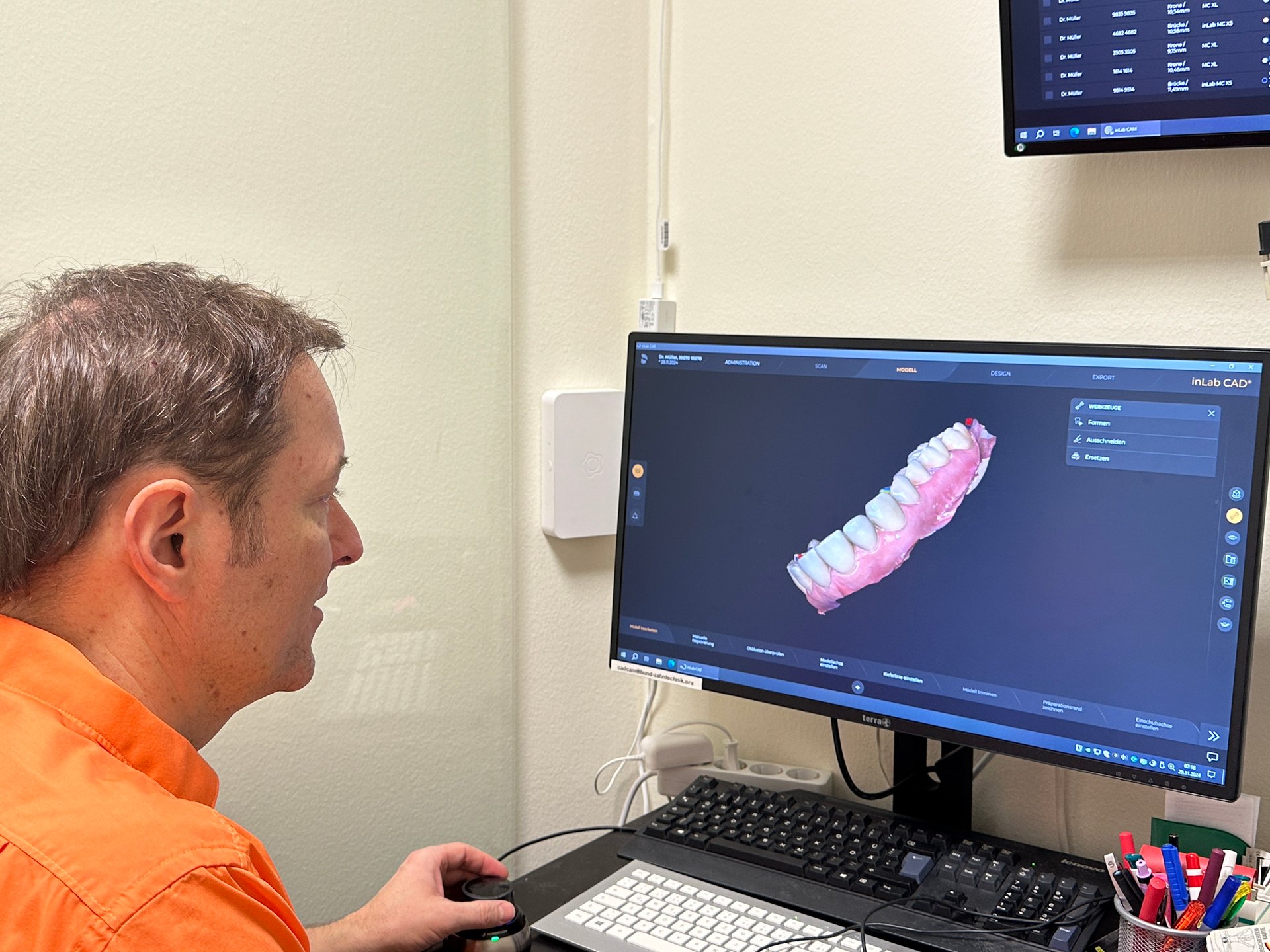 Digitale Planung des Zahnersatzes in der Tagesklinik