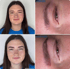 Vorher-Nachher-Vergleich einer jungen Frau mit Augenbrauen-Microblading: oben ohne, unten mit perfekten Brauen.