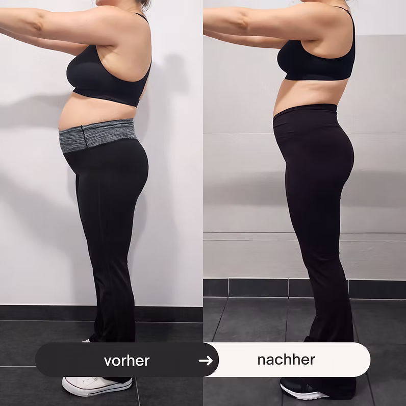 Vorher-Nachher-Vergleich einer Frau in Sportkleidung im Profil mit sichtbarer Veränderung der Bauch- und Gesäßpartie.