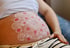 Zartes Mandala in Weiß und Rosa auf einem runden Babybauch – künstlerische Babybauchbemalung.
