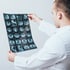 A doctor holds up a brain scan.