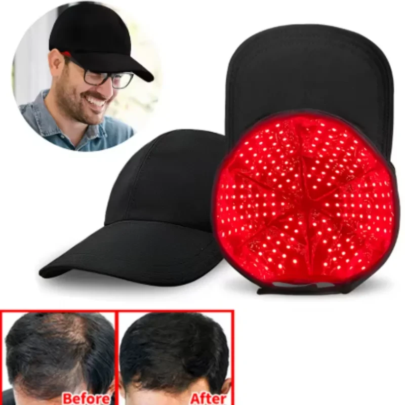 LLLT LaserCap gegen beginnenden Haarausfall – dein 15-Minuten-Ritual am Abend
