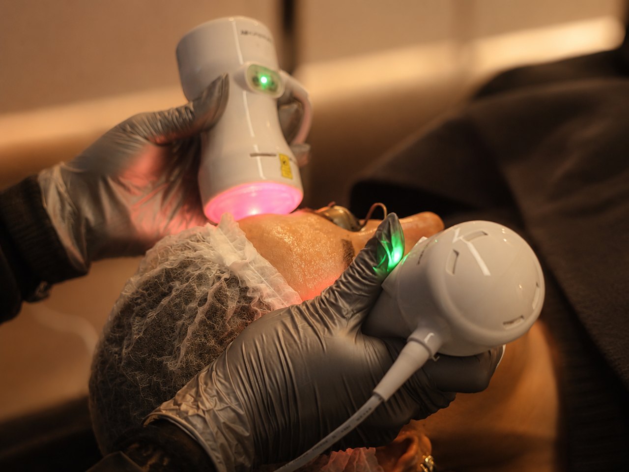 BYONIK® Laserhandstücke mit Pulssensor und Hyaluron-Gel im SWON Studio in Pforzheim