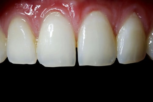 dental-photo-systeme_Kontrastor